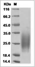 Human IL3 / IL-3 Protein (His Tag)