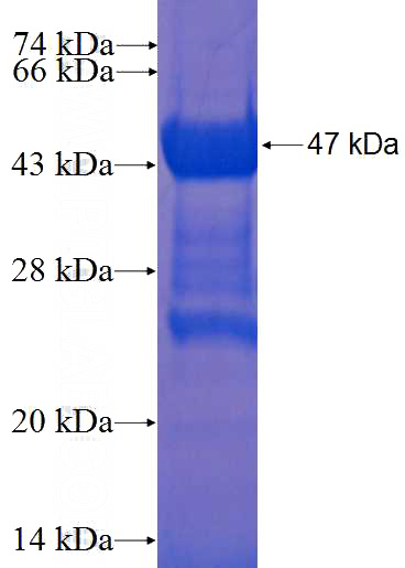 Recombinant Human TNNI2 SDS-PAGE