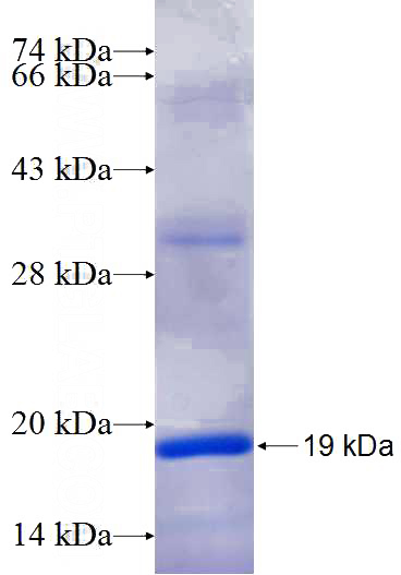 Recombinant Human RASGRP1 SDS-PAGE