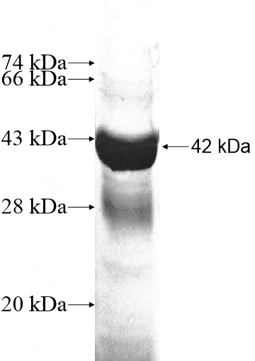 Recombinant Human CIB3 SDS-PAGE