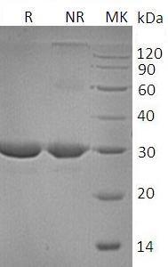Human PMM2 (His tag) recombinant protein