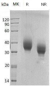 Human SLAMF6/KALI/UNQ6123/PRO20080 (His tag) recombinant protein