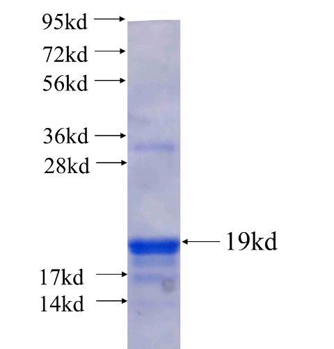 Recombinant human CRCP(Full length) SDS-PAGE