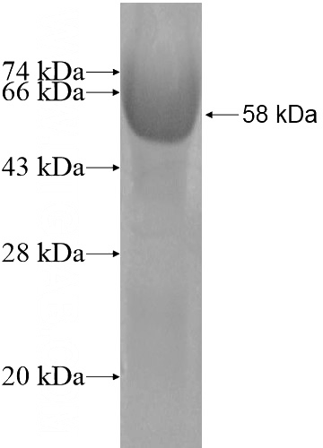 Recombinant Human JAKMIP2 SDS-PAGE
