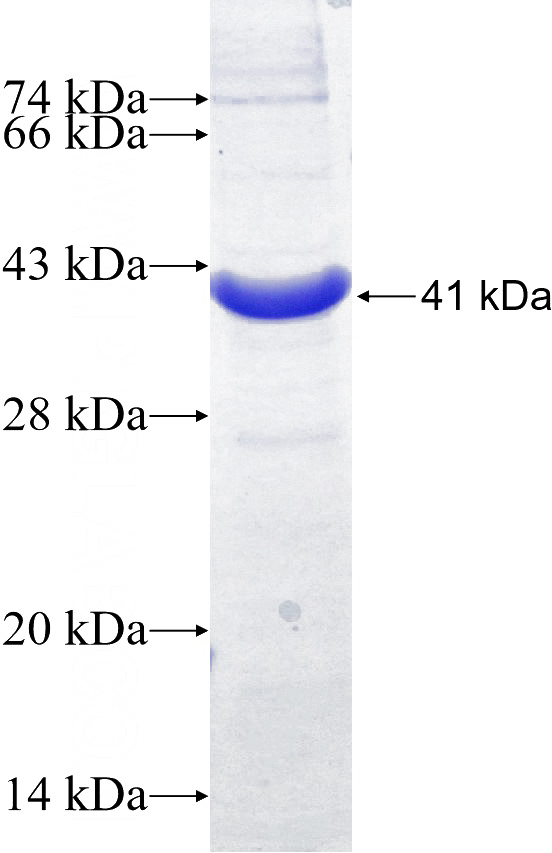 Recombinant Human GP1BA SDS-PAGE