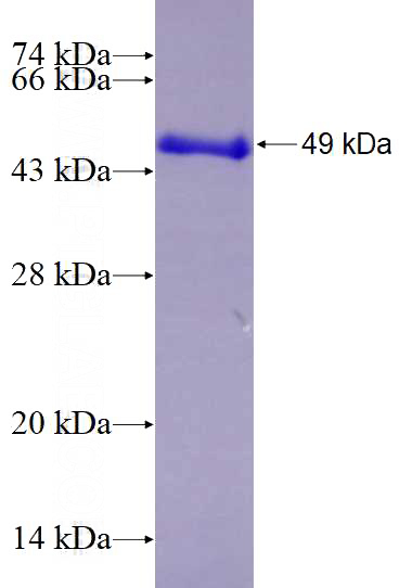 Recombinant Human ETV4 SDS-PAGE