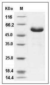 Human CD32a / FCGR2A Protein (167 Arg, Fc Tag) SDS-PAGE