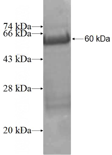 Recombinant Human MPP7 SDS-PAGE