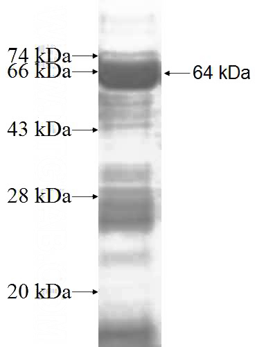Recombinant Human DDX24 SDS-PAGE