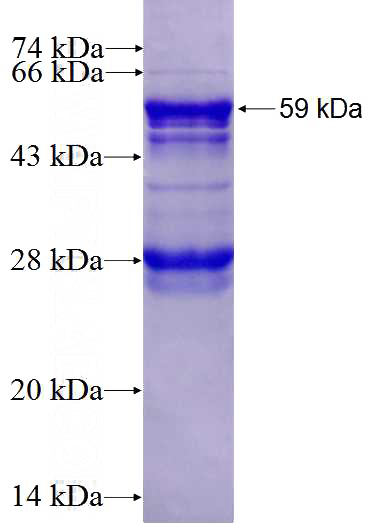 Recombinant Human IKBKG SDS-PAGE