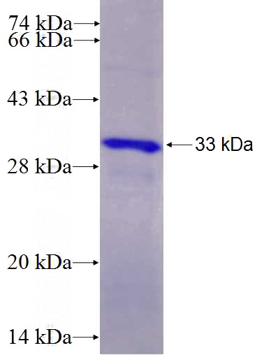 Recombinant Human PCSK4 SDS-PAGE