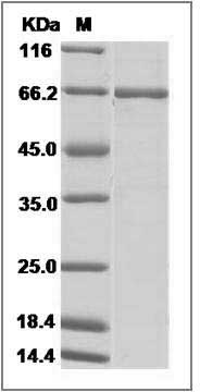 Human ABL1 / JTK7 / p150 Protein (GST Tag) SDS-PAGE