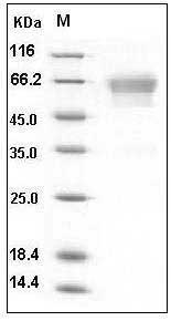 Mouse Podoplanin / PDPN Protein (His & Fc Tag) SDS-PAGE