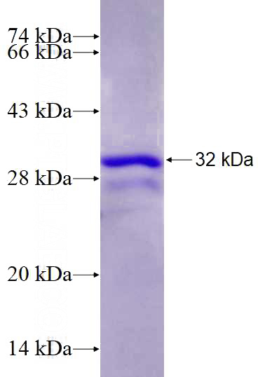 Recombinant Human USPL1 SDS-PAGE