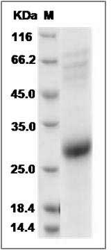 Rat CD70 / CD27L / TNFSF7 Protein (His Tag) SDS-PAGE