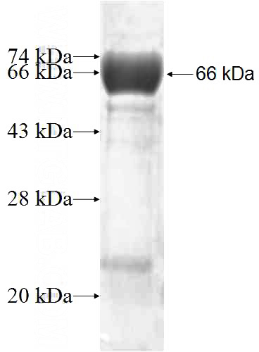 Recombinant Human GFM1 SDS-PAGE