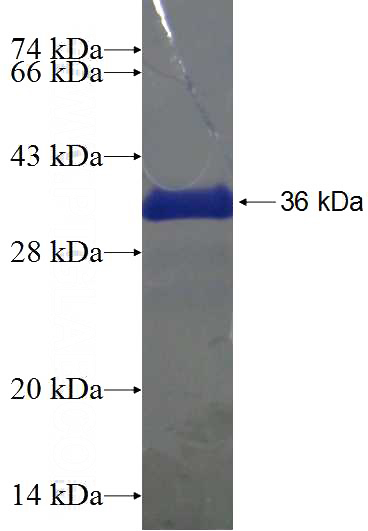 Recombinant Human SPAG9 SDS-PAGE