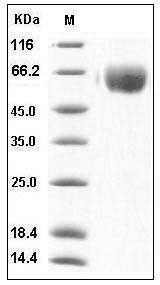 Human TGFBR2 Protein (His & Fc Tag) SDS-PAGE