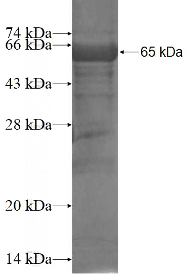 Recombinant Human KIAA0391 SDS-PAGE