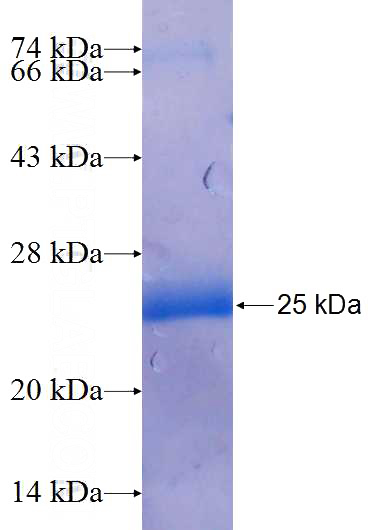 Recombinant Human LPIN1 SDS-PAGE