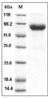 Mouse ACVR2B Protein (His & Fc Tag) SDS-PAGE