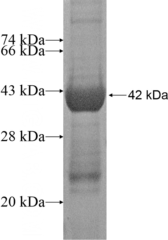 Recombinant Human SERPINB11 SDS-PAGE