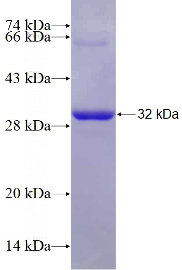 Recombinant Human RAB26 SDS-PAGE