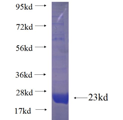 Recombinant Arabidopsis thaliana NDPK2 SDS-PAGE