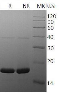 Human IL37/FIL1Z/IL1F7/IL1H4/IL1RP1 recombinant protein