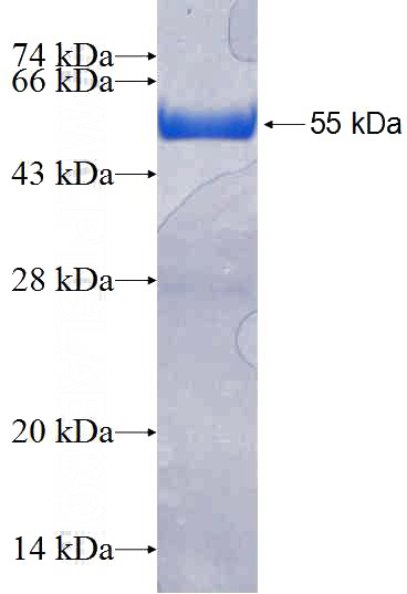 Recombinant Human CCDC53 SDS-PAGE