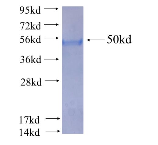 Recombinant human RANBP9 SDS-PAGE