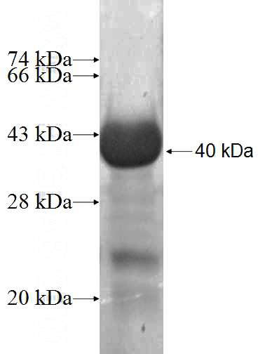 Recombinant Human NID2 SDS-PAGE