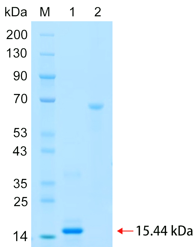 Recombinant SMD3 protein (His tag) SDS-PAGE