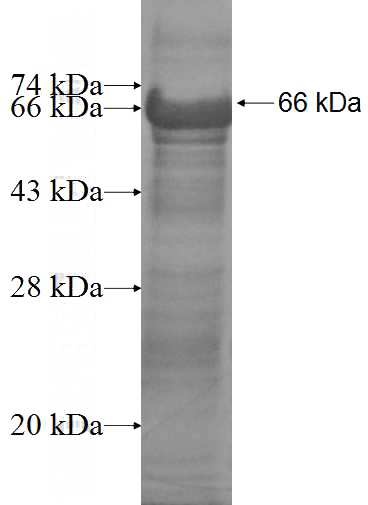 Recombinant Human PPP2R3A SDS-PAGE