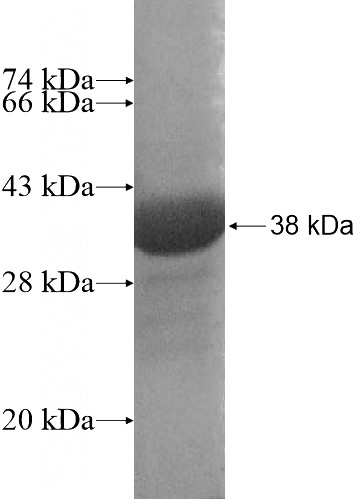 Recombinant Human C17orf37 SDS-PAGE