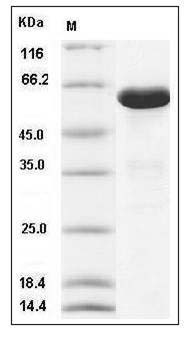 Human ANXA6 / Annexin A6 / Annexin6 Protein (His Tag) SDS-PAGE