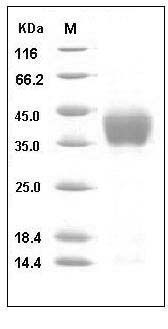 Mouse ASGPR1 / ASGR1 Protein (His Tag) SDS-PAGE