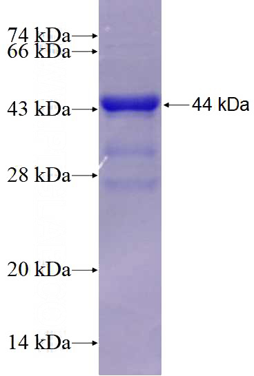 Recombinant Human PHLPP SDS-PAGE