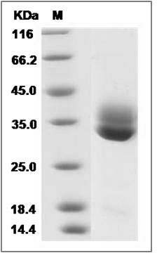 Human CTRL-1 / CTRL / Chymotrypsin-like protease Protein (His Tag) SDS-PAGE