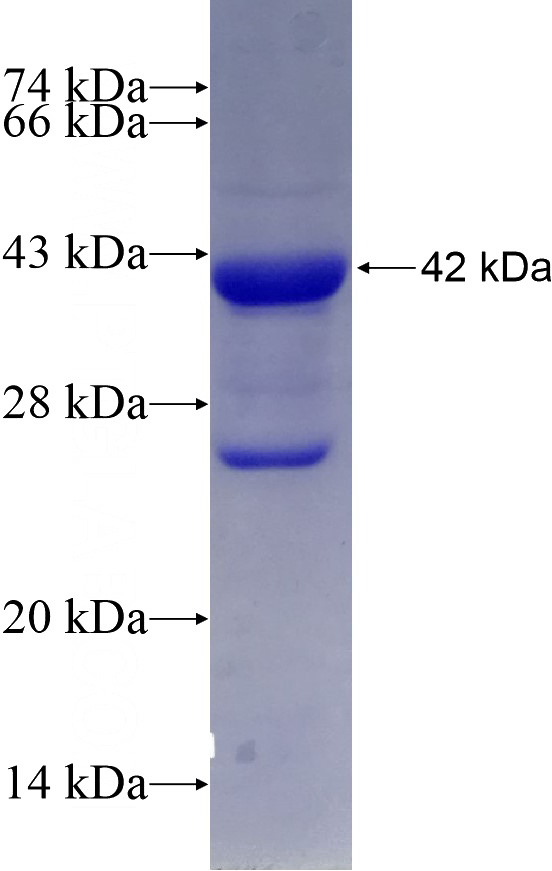 Recombinant Human MDH2 SDS-PAGE