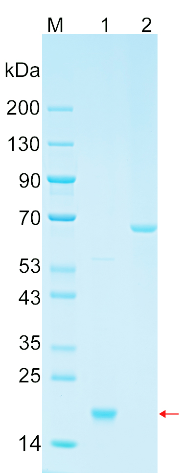 Recombinant NOXA1 protein (His tag) SDS-PAGE