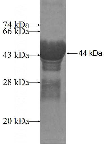 Recombinant Human HBXIP SDS-PAGE