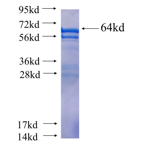Recombinant human CYTSB SDS-PAGE