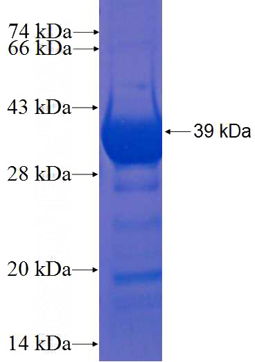 Recombinant Human IQCK SDS-PAGE