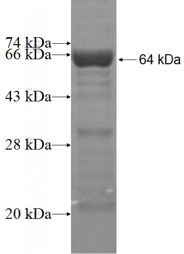 Recombinant Human BTBD7 SDS-PAGE