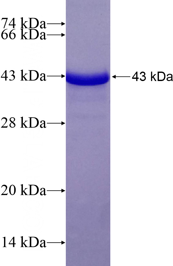 Recombinant Human GAB2 SDS-PAGE