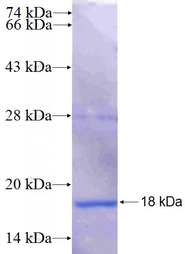 Recombinant Human ATPIF1 SDS-PAGE