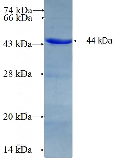 Recombinant Human GNL3 SDS-PAGE