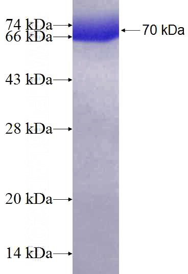 Recombinant Human dynactin-2 SDS-PAGE