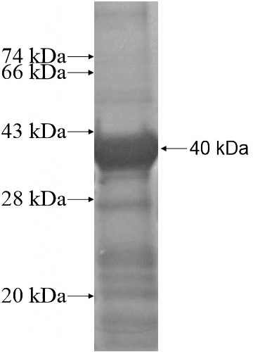 Recombinant Human ZNF230 SDS-PAGE